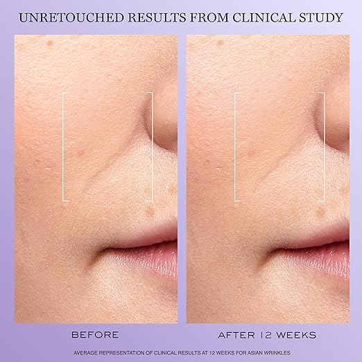 Lancôme Rénergie H.C.F. Triple Serum - Hyaluronic Acid Serum for Visible Correction of Anti Aging Signs & Dark Spots - With Vitamin C+, Niacinamide & Ferulic Acid