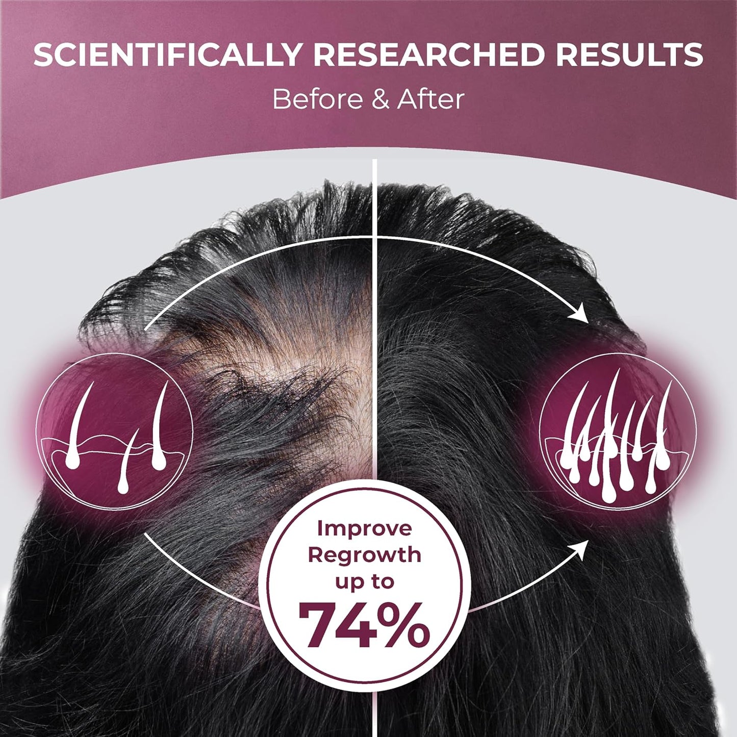 PUREHEALTH RESEARCH ReGrow Hair Growth Vitamins – Biotin, Saw Palmetto & Collagen – 60 Capsules