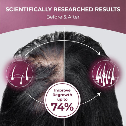 PUREHEALTH RESEARCH ReGrow Hair Growth Vitamins – Biotin, Saw Palmetto & Collagen – 60 Capsules